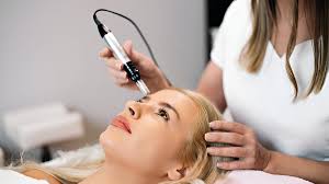 Adapting Microneedling Treatment for Various Skin Conditions